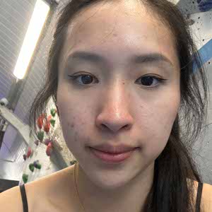 dalen lim profile