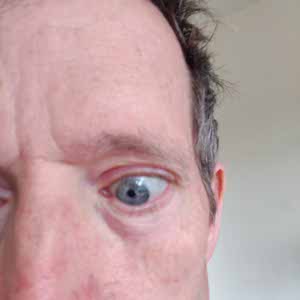 Matt Burrows profile