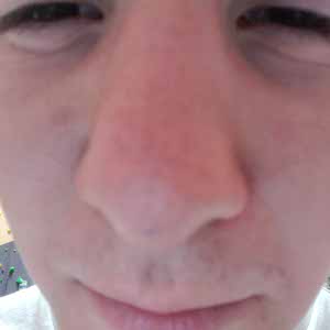 Cedruc Josephy profile